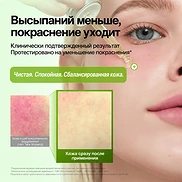 ANUA AZELAIC ACID 10 HYALURON REDNESS SOOTHING SERUM (30ml)
