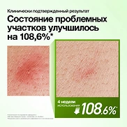 ANUA AZELAIC ACID 10 HYALURON REDNESS SOOTHING SERUM (30ml)