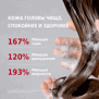 MOEV ANNURCATIN™ SHAMPOO (525ml)