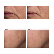 THE ORDINARY RETINAL 0.2% EMULSION (15ml)