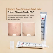 HANMI PRO CALM EGF ACTIVE VITAL CREAM (20ml)
