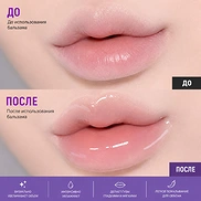 BIOHEAL-BOH PROBIODERM COLLAGEN VOLUME LIP PLUMPER (10ml)