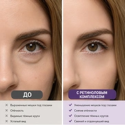 DR.MELAXIN EYEPHALT RETINOL EYEBAG CREAM (10gr)