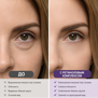 DR.MELAXIN EYEPHALT RETINOL EYEBAG CREAM (10gr)