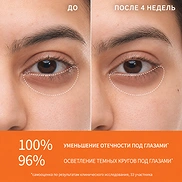 SULWHASOO FIRST CARE ACTIVATING EYE SERUM (20ml)