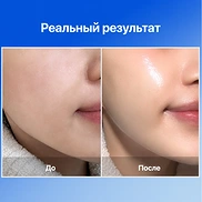 MEDITHERAPY BLUE LAYER WATER DOME MASK (34gr * 4ea)