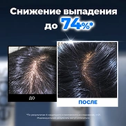 EPAIS SCALP BOOSTING AMPOULE (150ml)